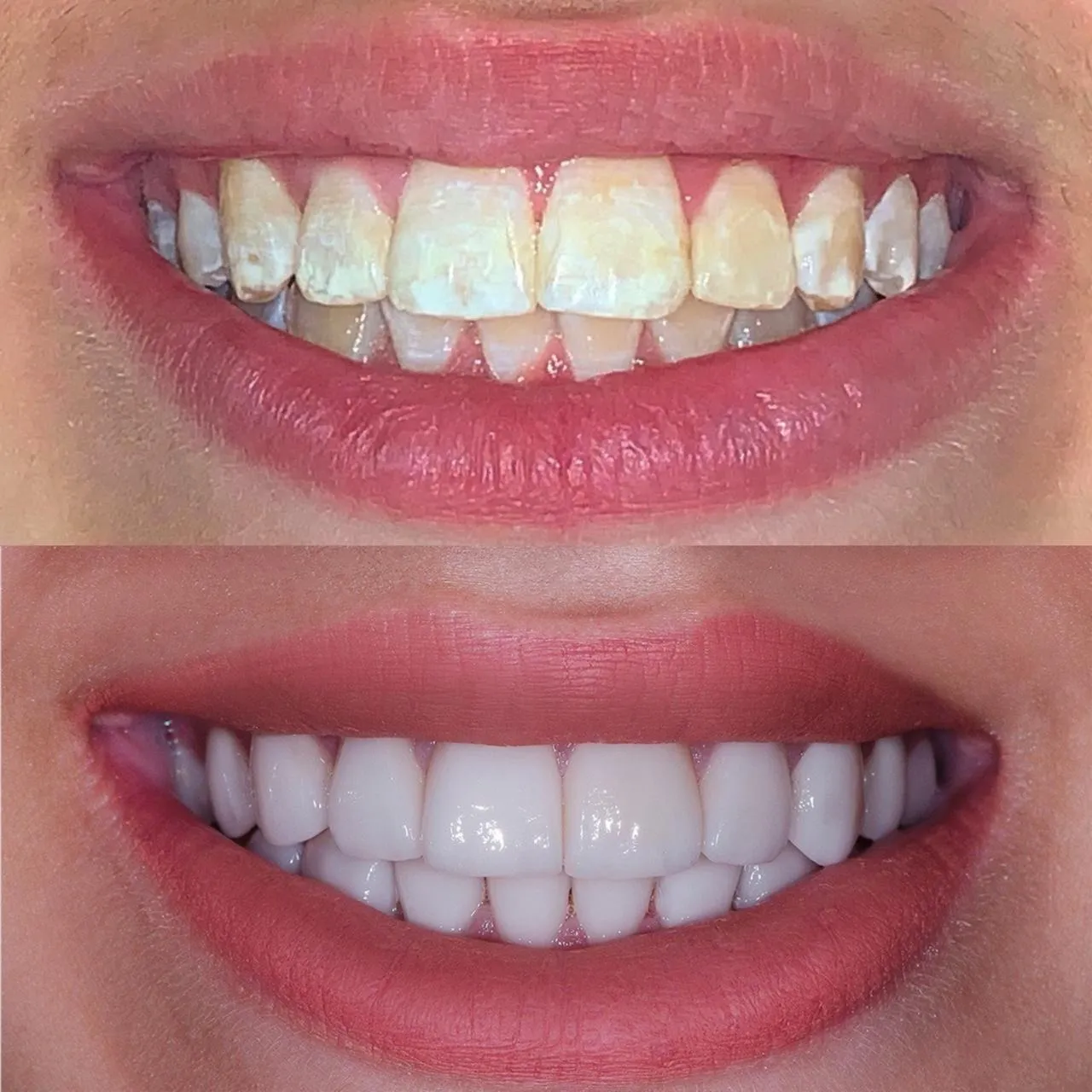 Resultado de tratamento odontológico 10
