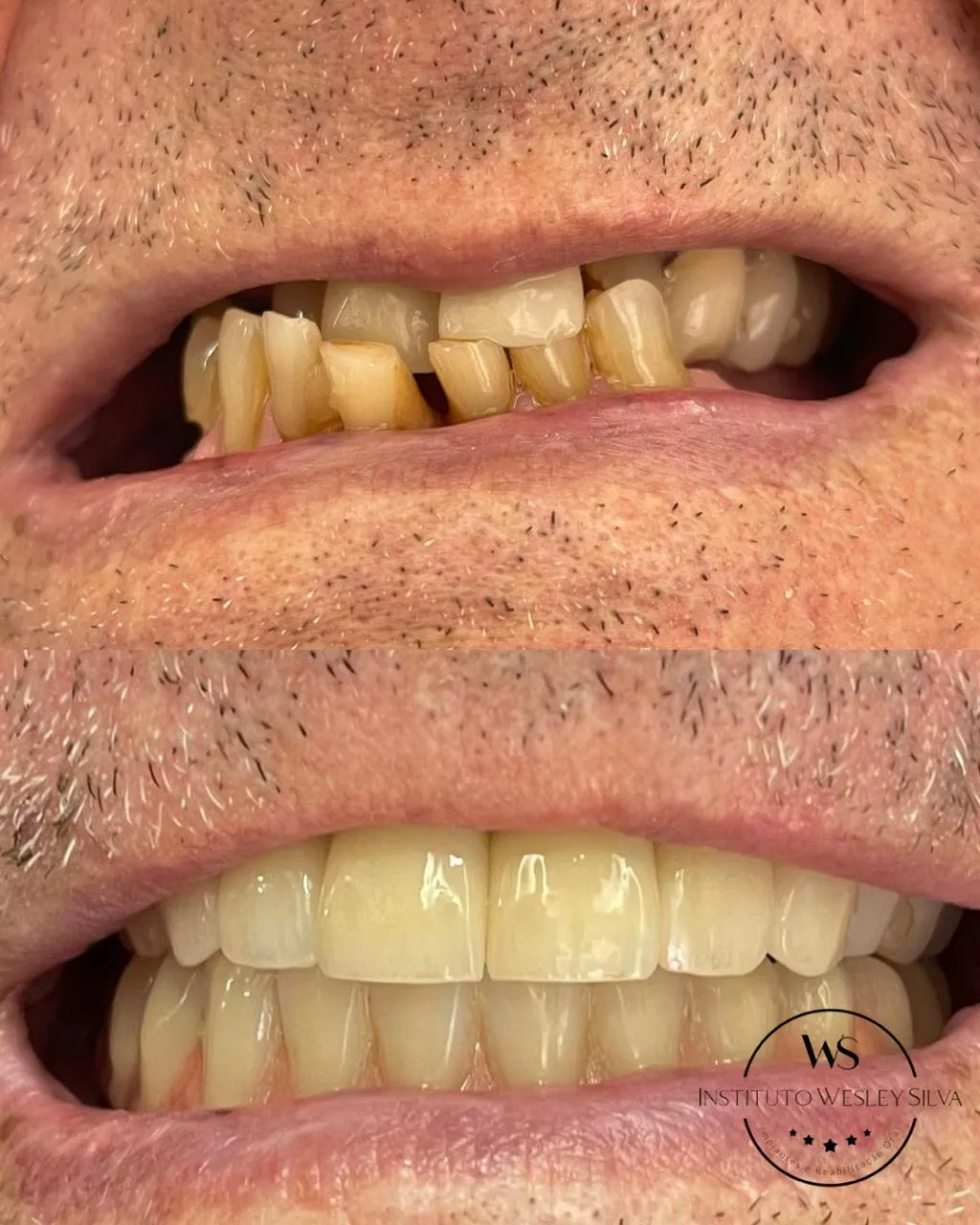 Resultado de tratamento odontológico - Caso recente 2