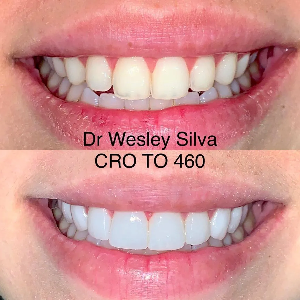 Resultado de tratamento odontológico 3