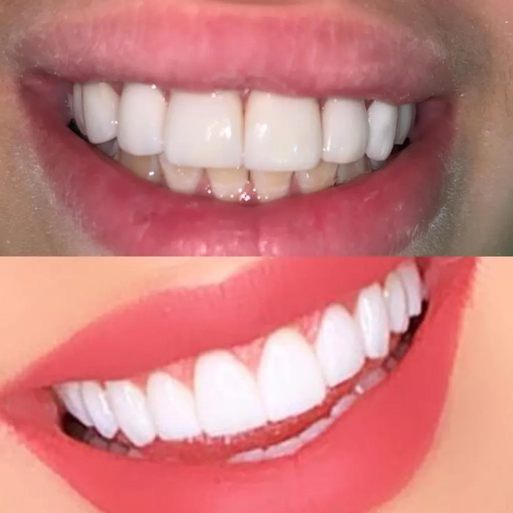 Resultado de tratamento odontológico 4