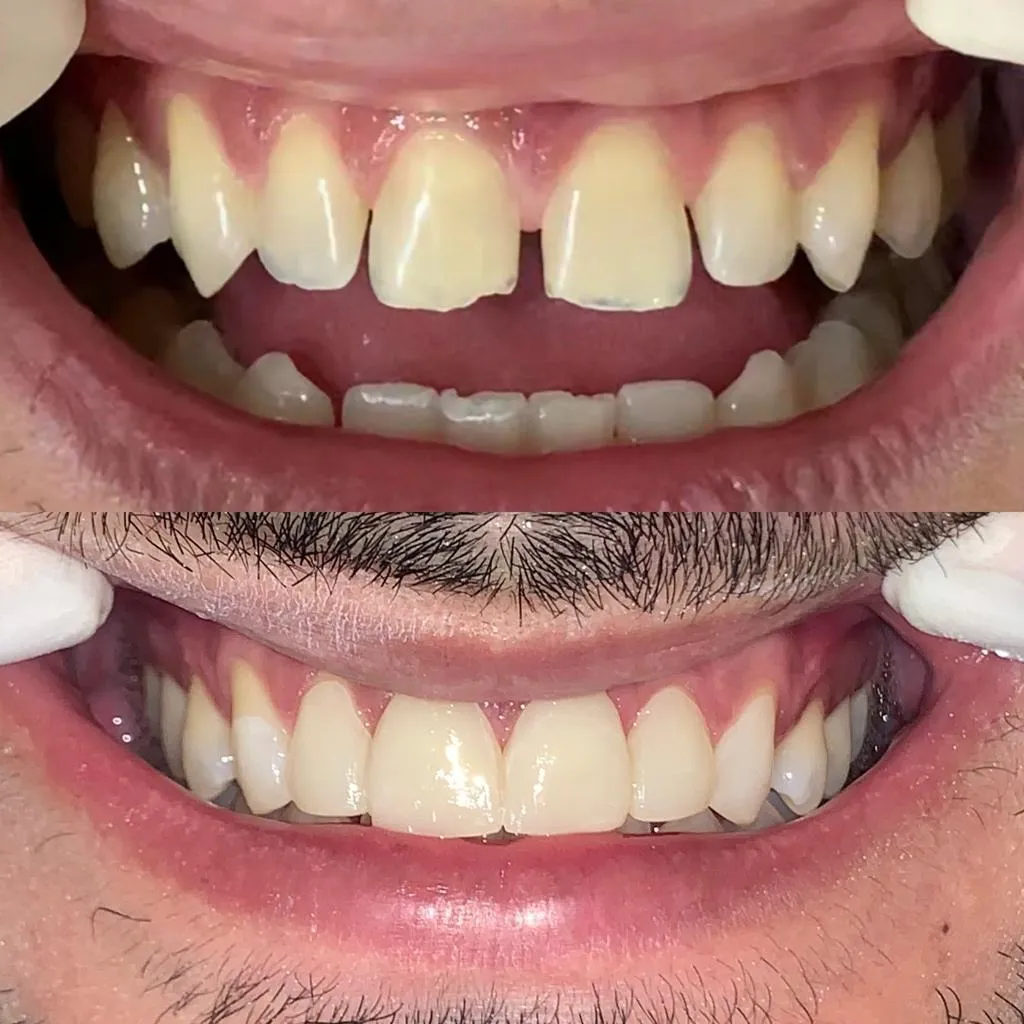 Resultado de tratamento odontológico 6