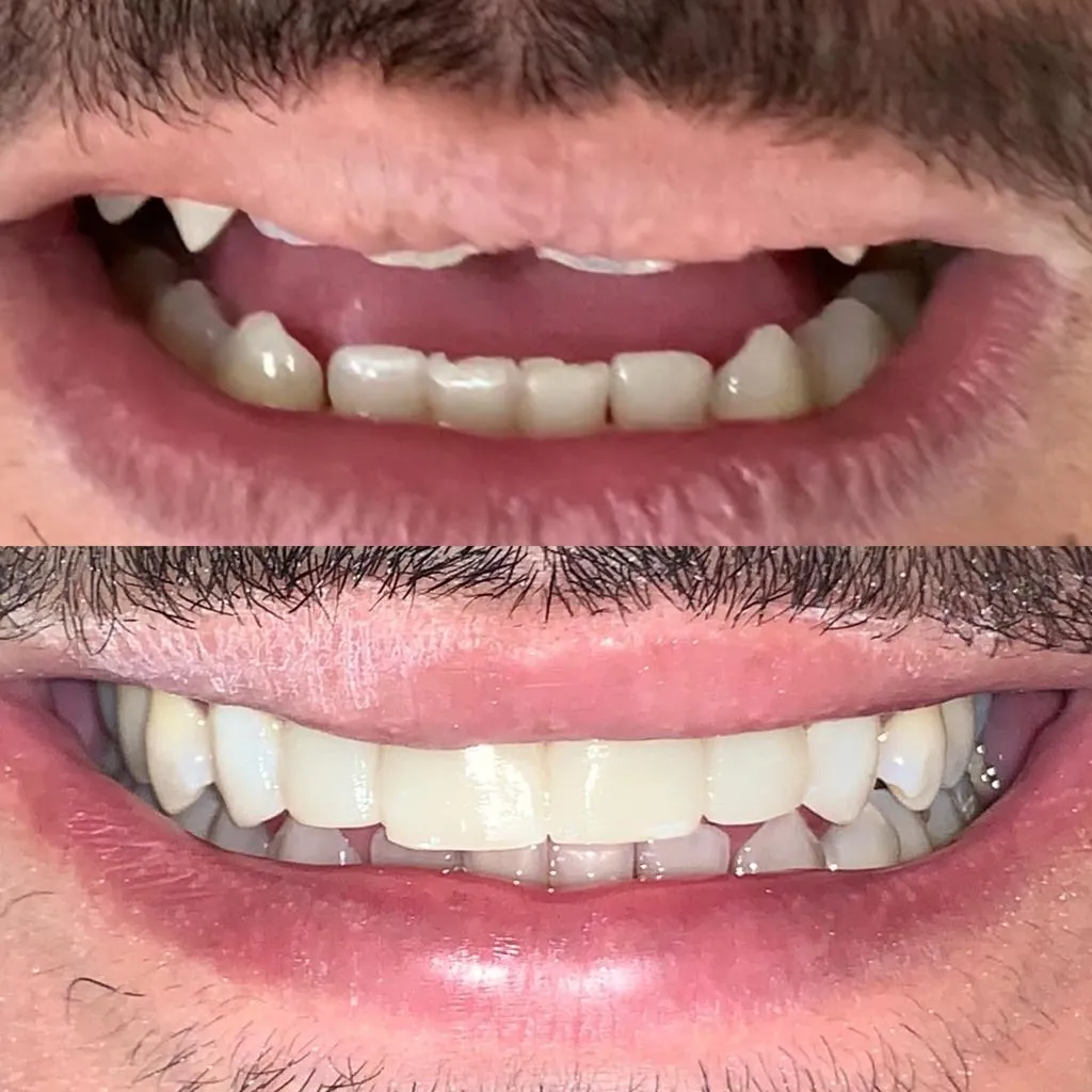 Resultado de tratamento odontológico 7
